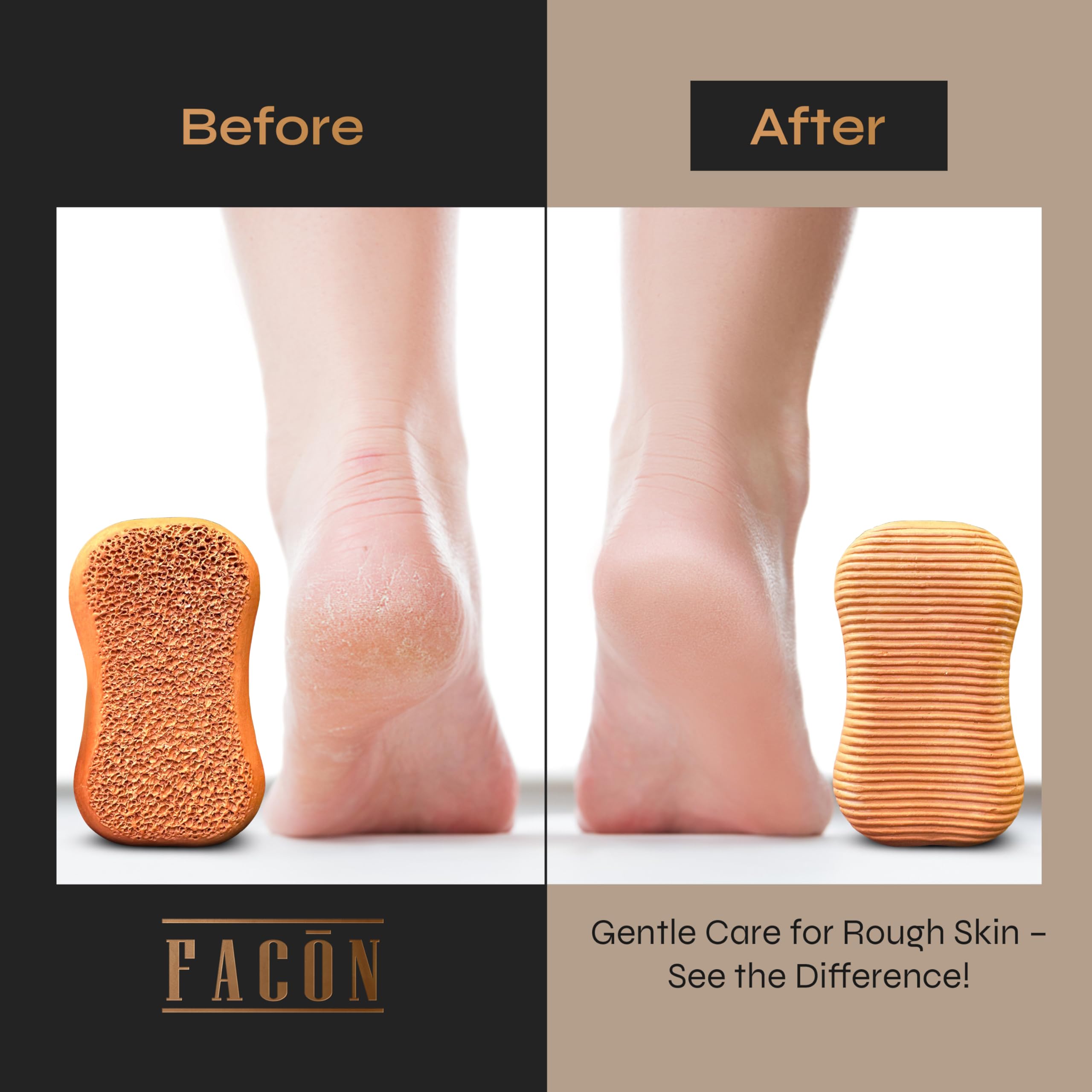 FACON pumice stone softens dry skin for comfortable routine care.