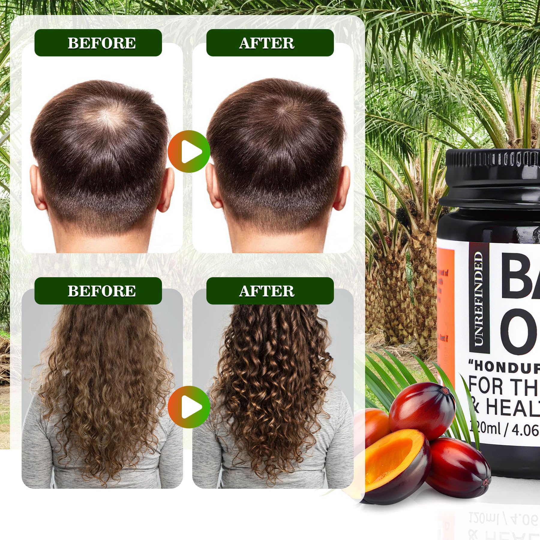 Fadelo Batana Oil suitable for all hair types and textures.