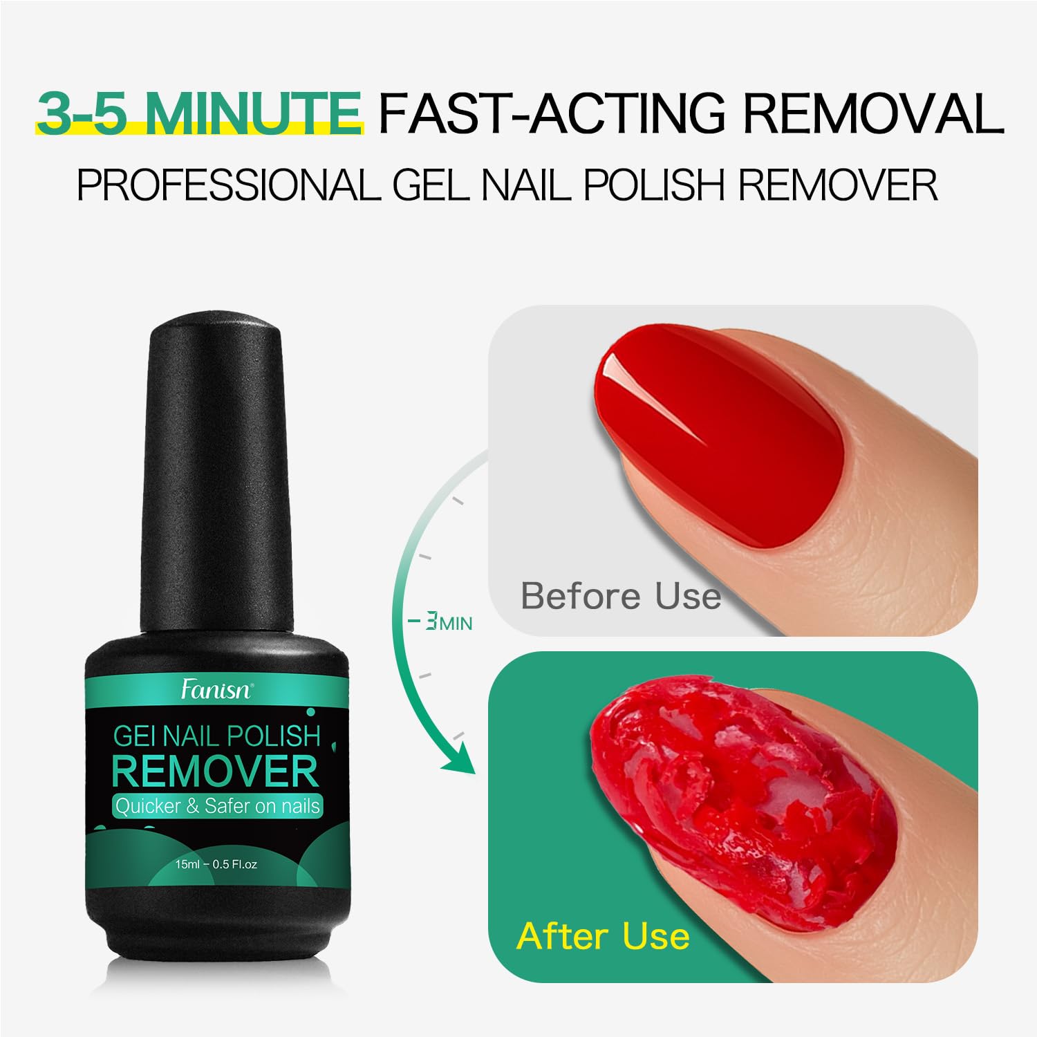 Fanisn gel nail remover tools set showcases included pads, file, pusher for complete removal.
