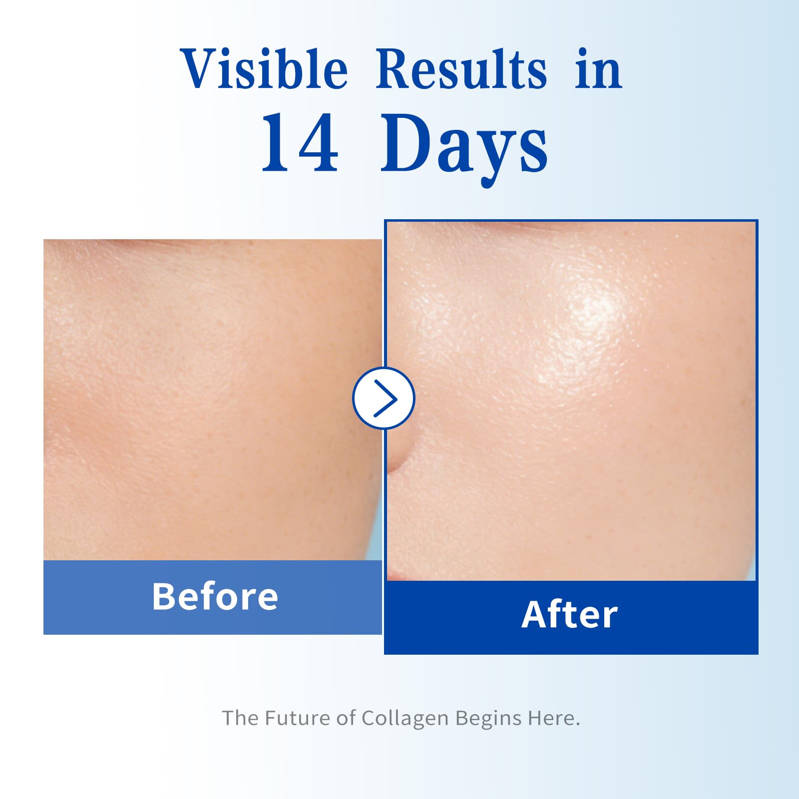 Fankr serum with centella calms irritated skin and supports barrier comfort