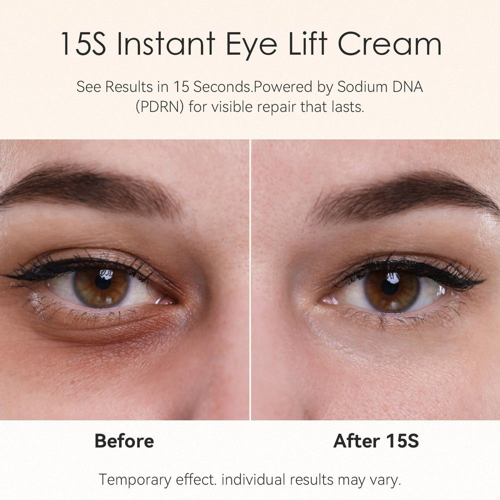 Fankr eye-area cream close-up illustrating smooth texture and brightened under-eye skin.