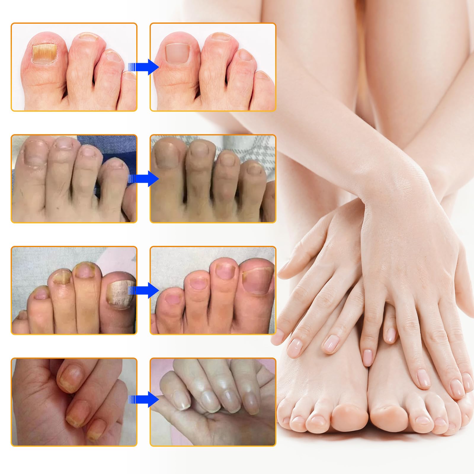 FANSHI portable nail care patches offer convenient night-time nail treatment.