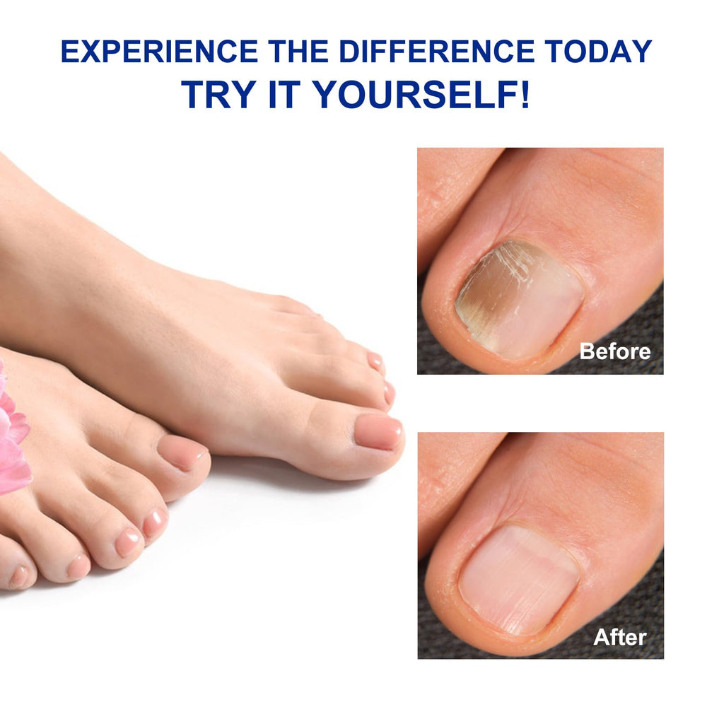 FANSHI travel-friendly nail care kit fits in a bag for on-the-go care.