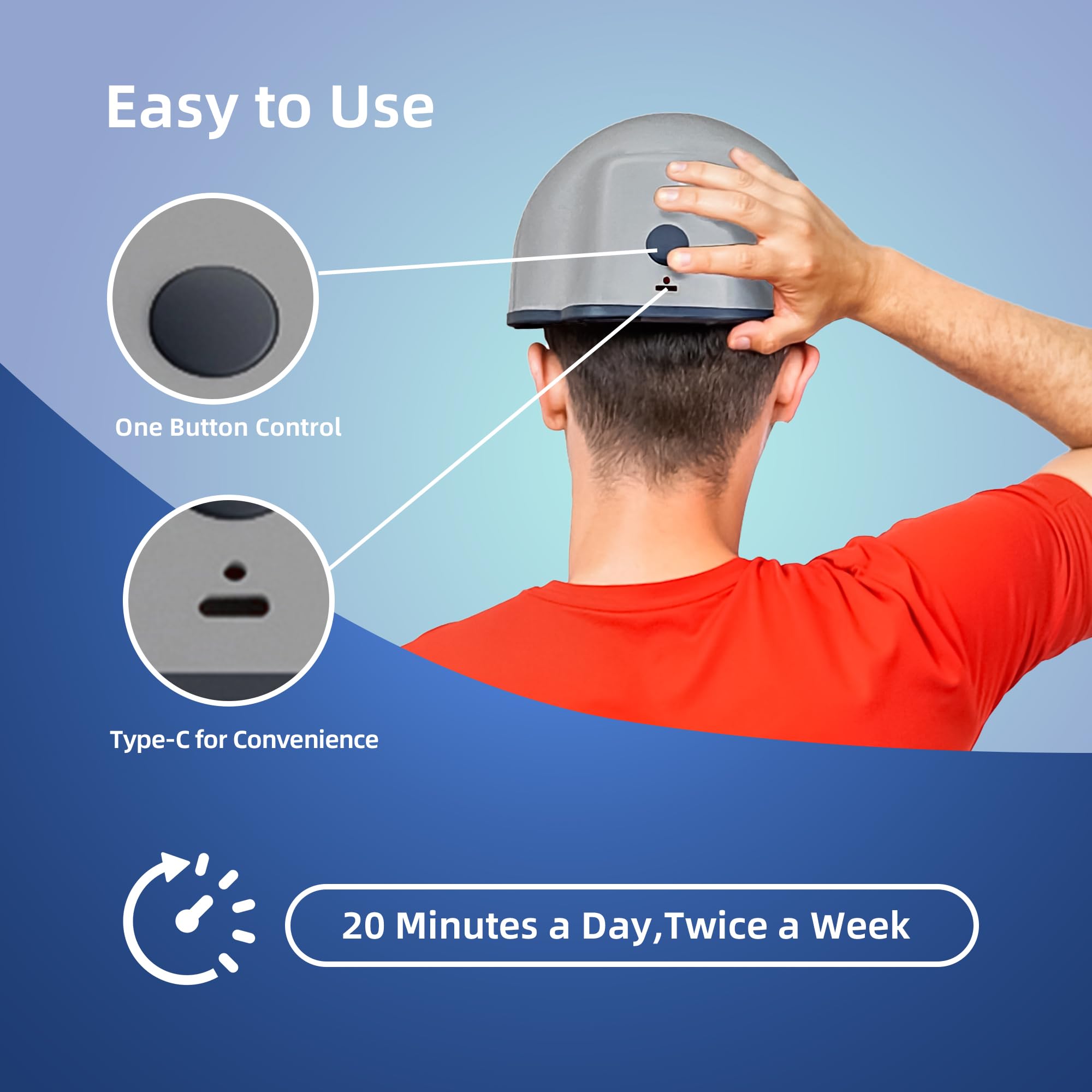faq101 Upper head coverage reaches hairline and temples for consistent treatment.