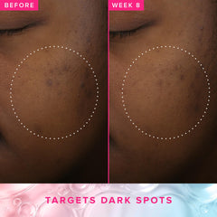 Farmacy toner bottle label close-up shows key active ingredients and benefits.