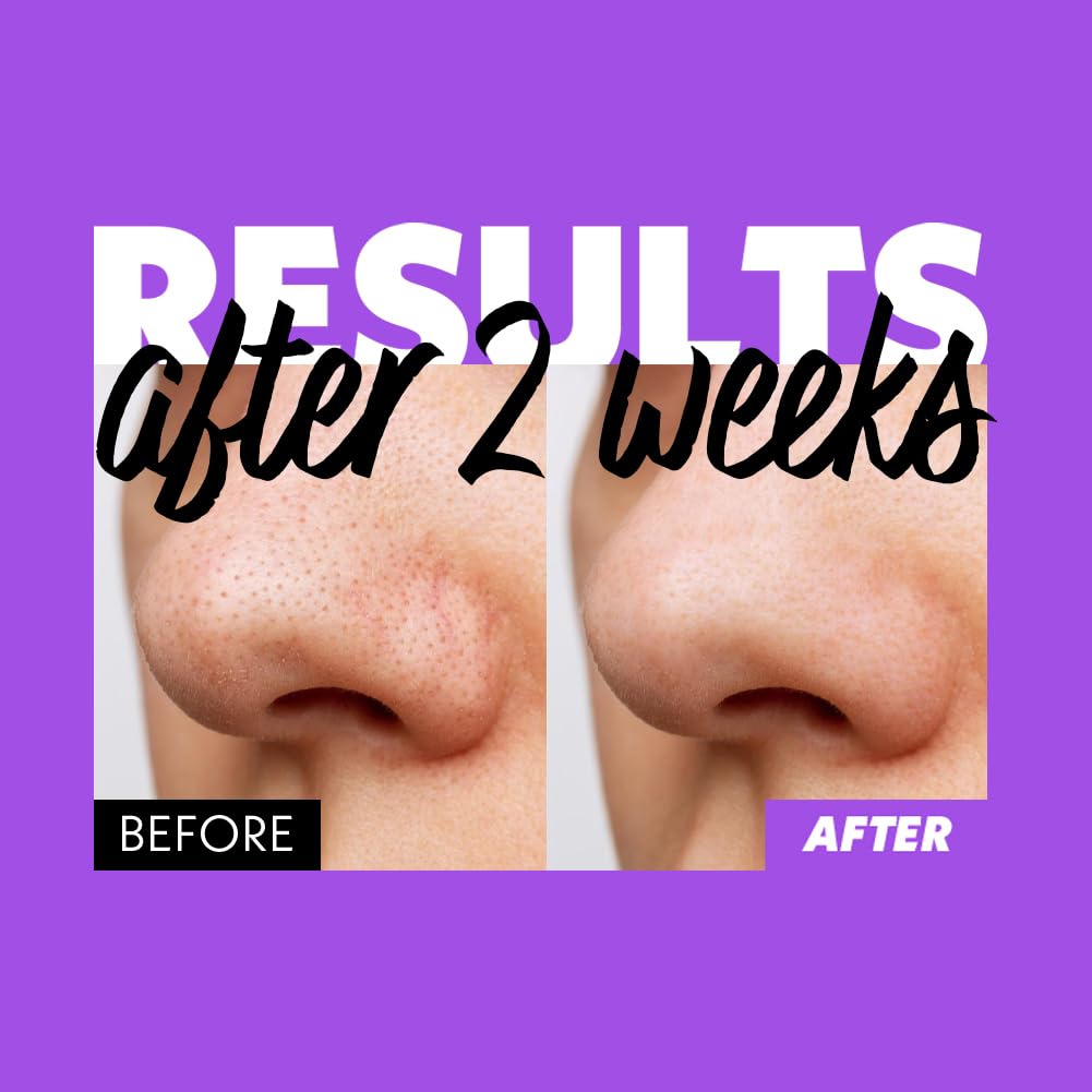 Fation Nosca9 retinal RX complex nourishes while purifying pores.