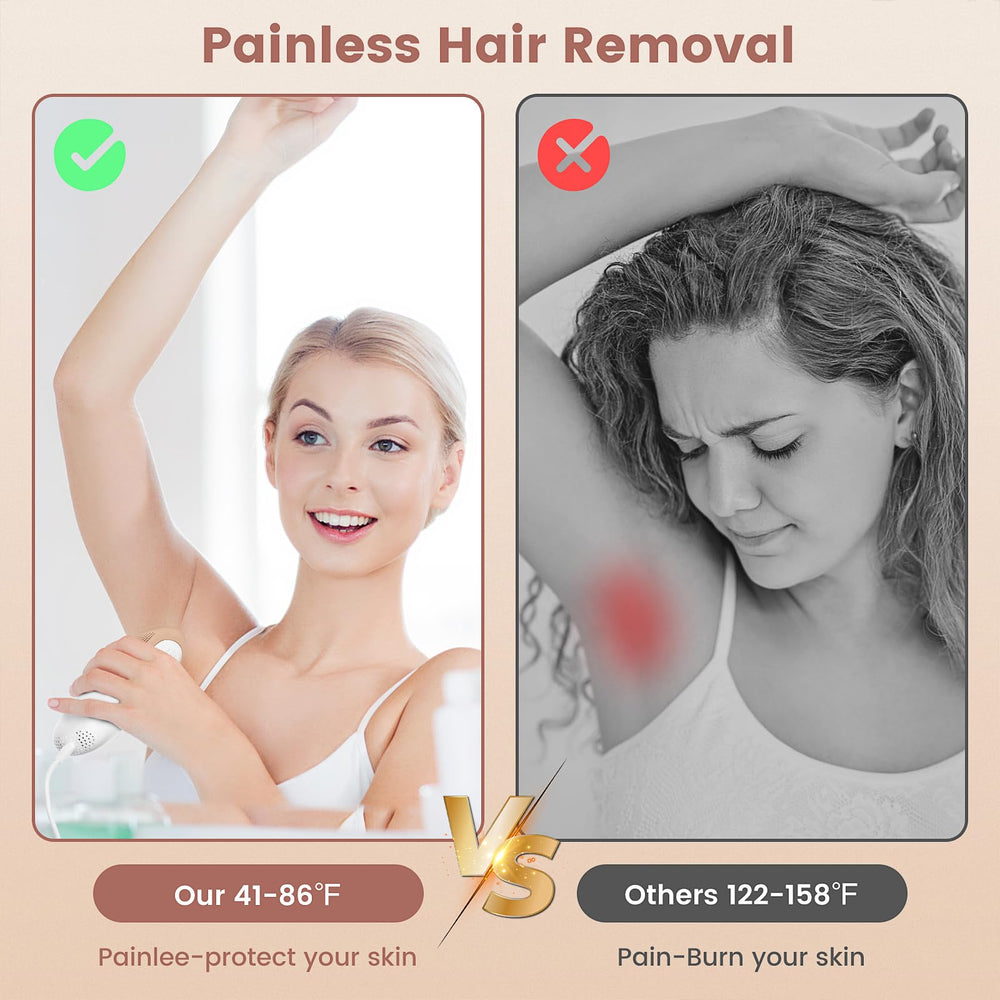 FELOOW S3 bikini-area treatment example