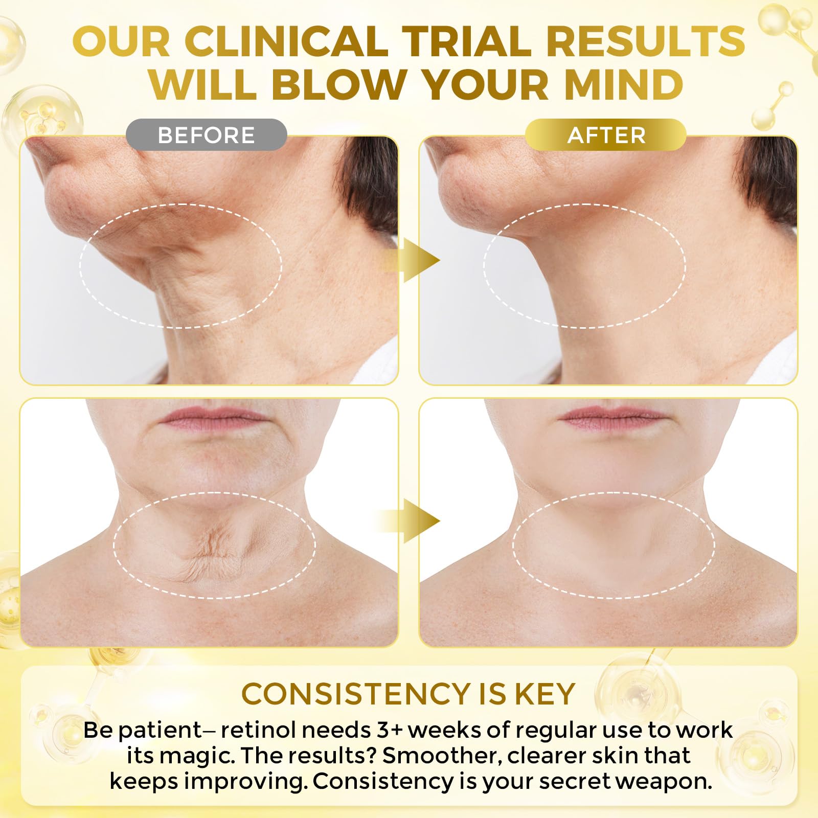 FeeMeFee Neck Cream close-up with peptide complex relaxing neck skin.