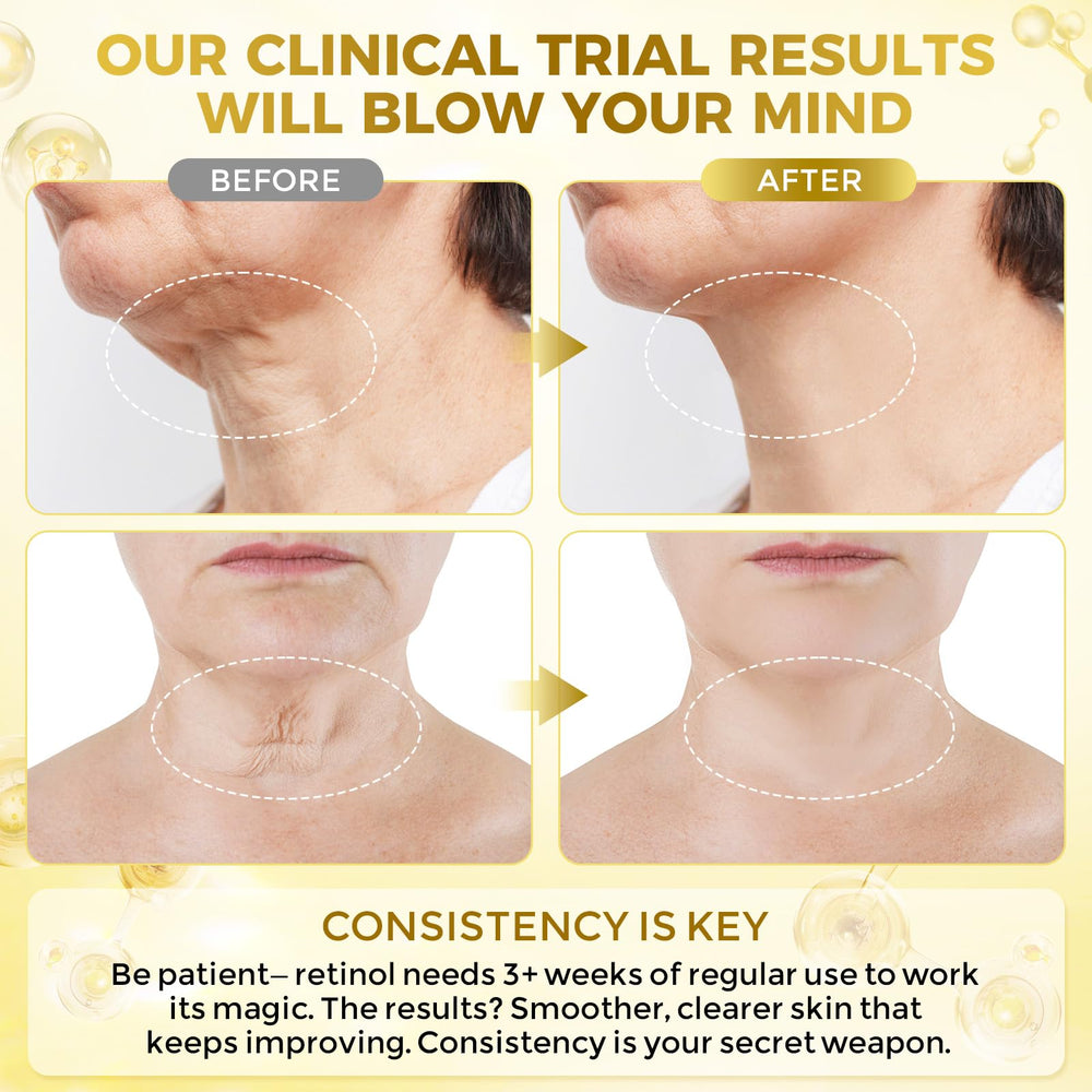 FeeMeFee Neck Cream close-up with peptide complex relaxing neck skin.