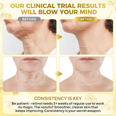 FeeMeFee Neck Cream close-up with peptide complex relaxing neck skin.