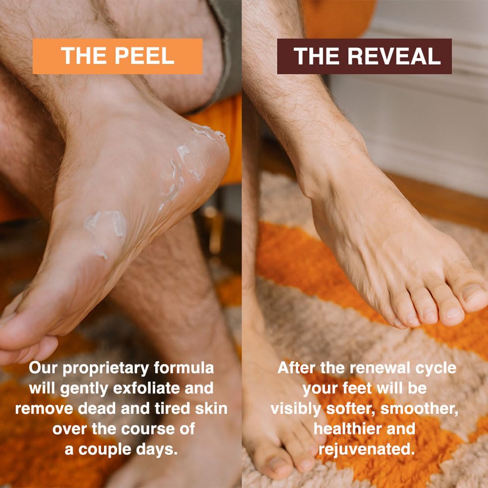 FEETS foot peel mask 60-90 minute treatment for convenient home care.