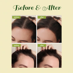 FEIBTH Hair Growth Oil application on hands demonstrating easy rub-in.