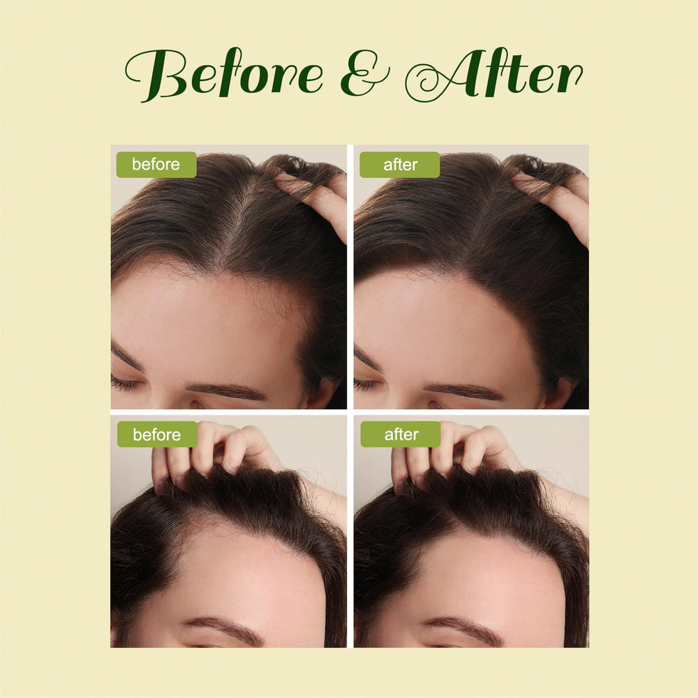 FEIBTH Natural Hair Growth Oil on scalp promotes gentle hydration and follicle vitality.