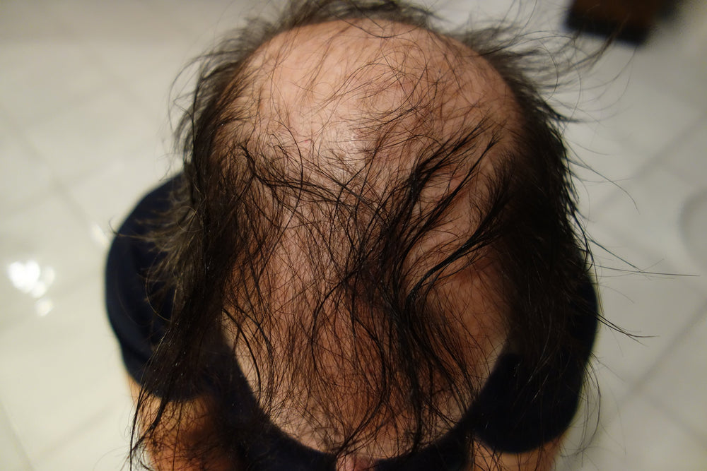 Finally Hair fibers application close-up shows quick, mess-free coverage.
