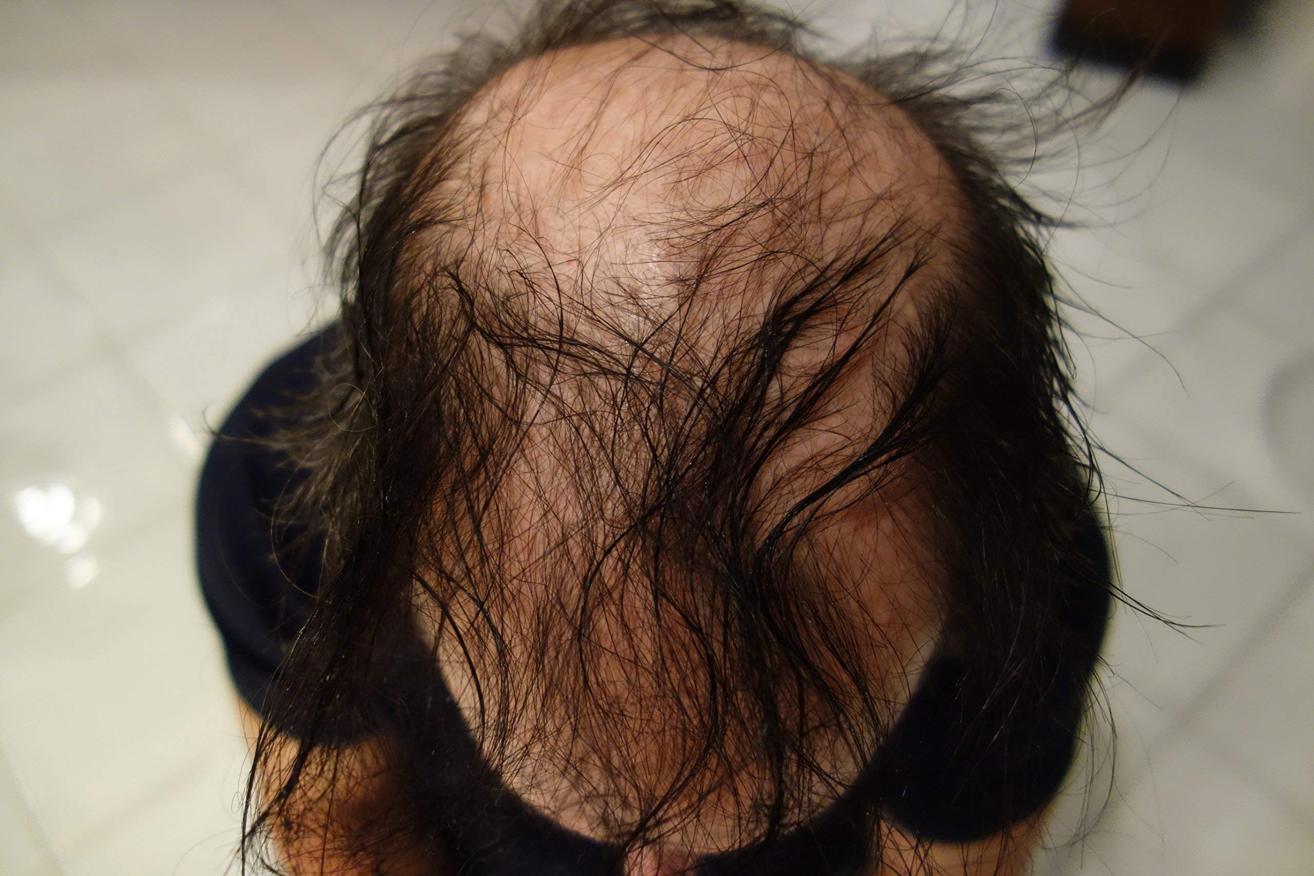 Finally Hair application-closeup demonstrates easy dusting for targeted coverage