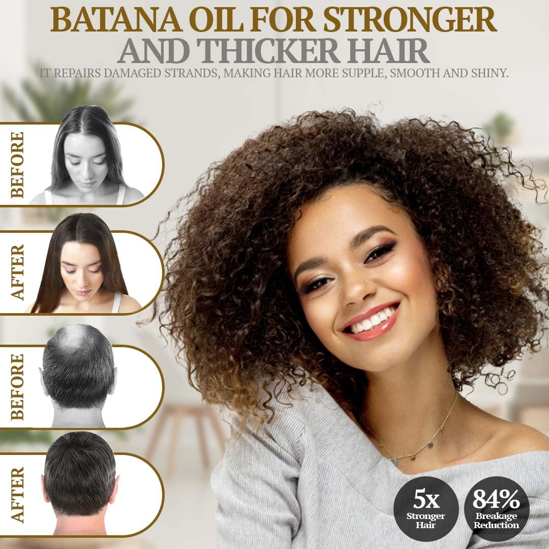 Fiora Naturals Batana Rosemary Oil drop on scalp stimulates circulation and comfort