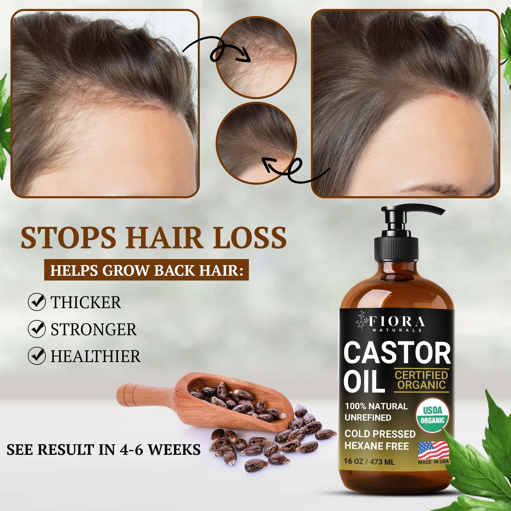 Fiora Naturals castor oil strengthens nails and softens cuticles