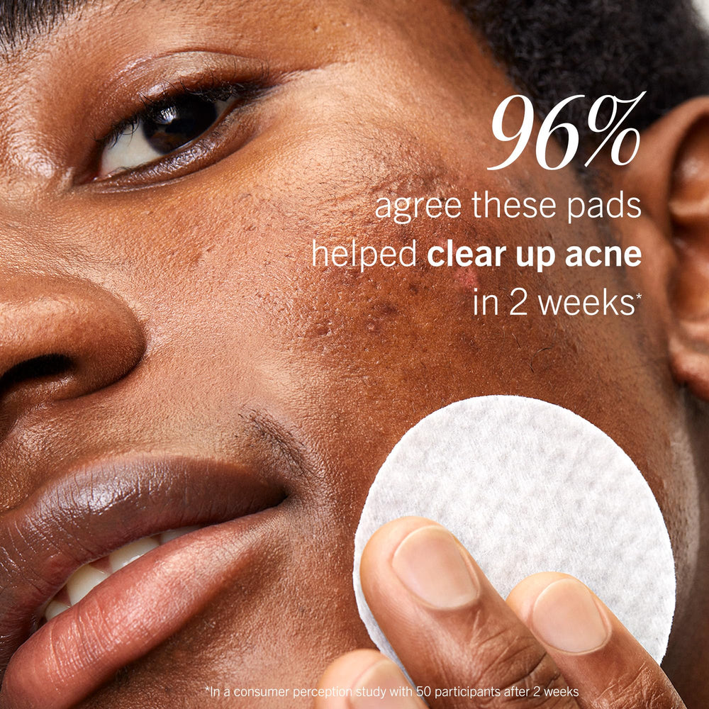 First Aid Beauty Acne Pads being used on acne-prone cheeks after cleansing.