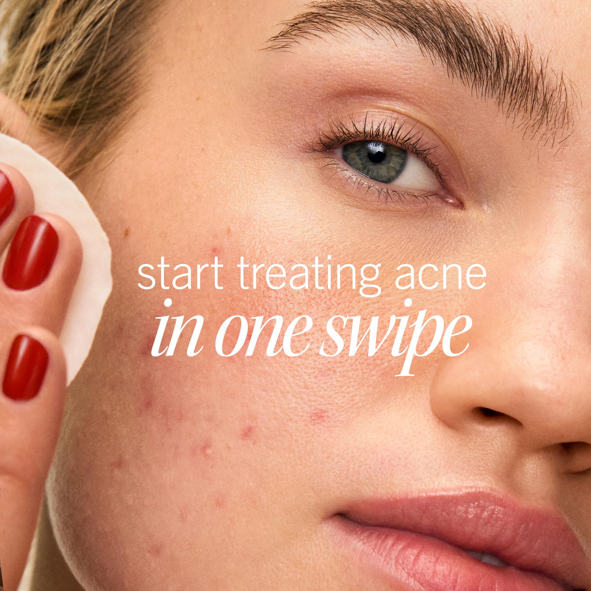 First Aid Beauty Acne Pads packaging tube highlighting compact, sustainable design.