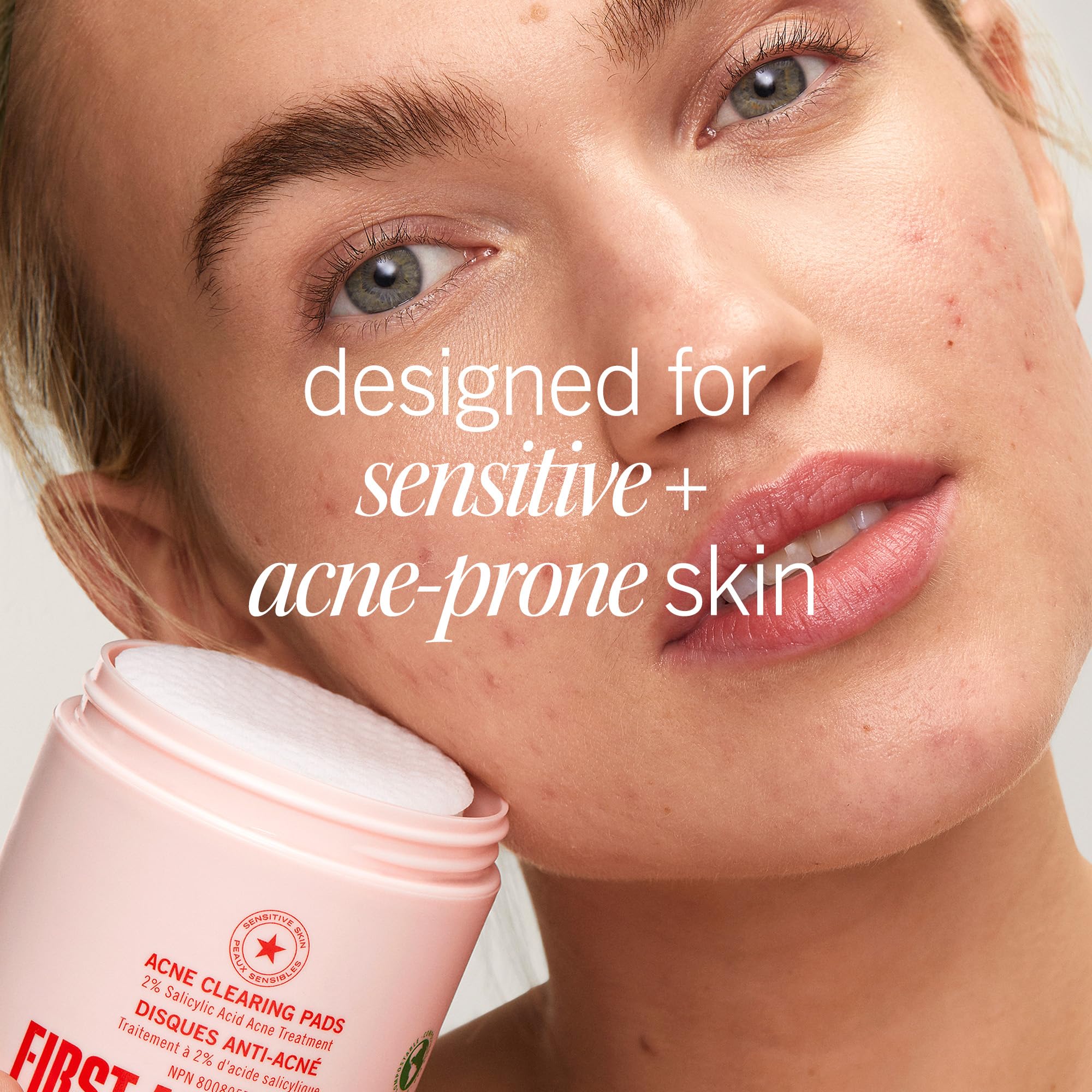First Aid Beauty Acne Pads soft texture close-up on skin.