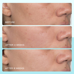 First Aid Beauty dark spot serum bottle cap focus on simple, non-irritating packaging.