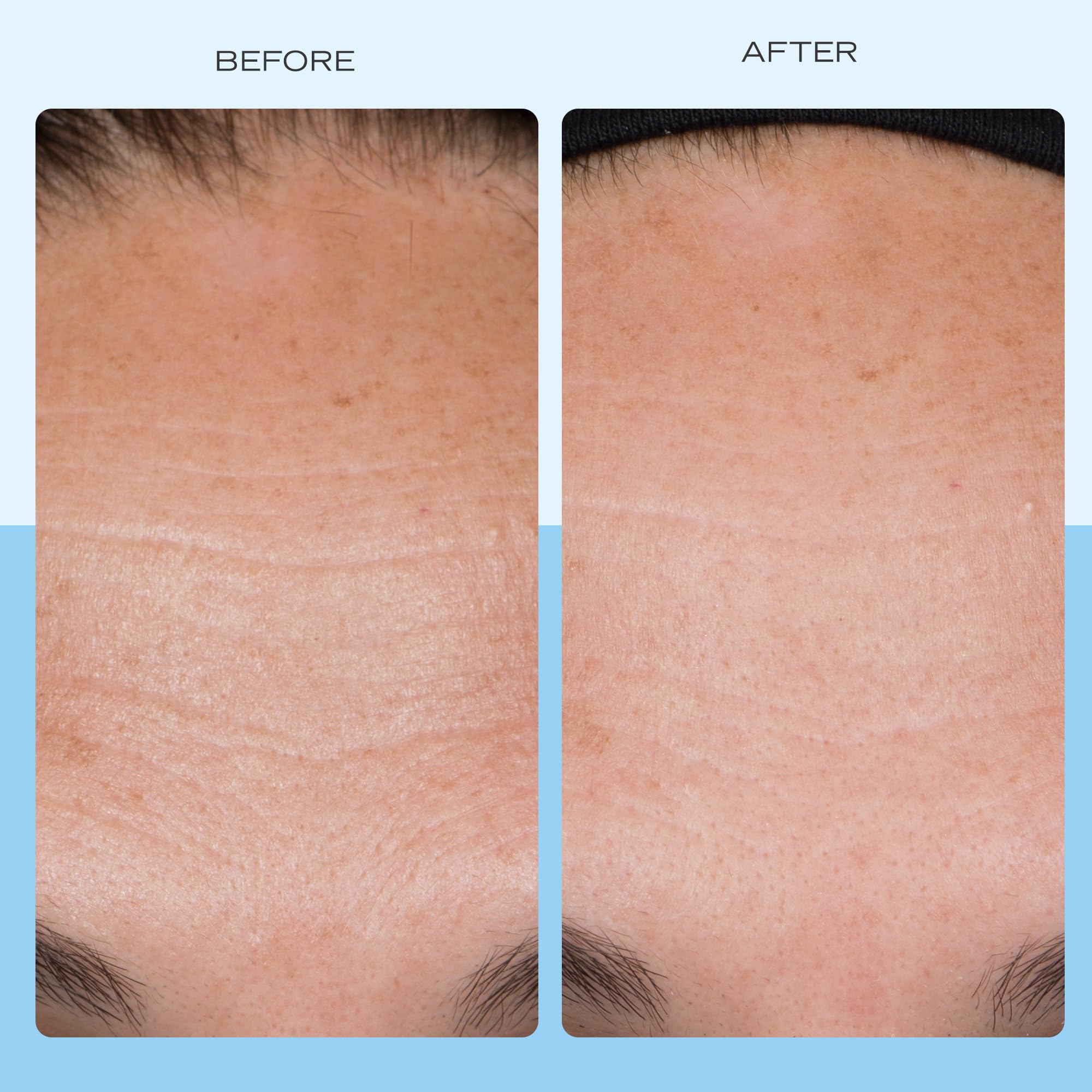 Dispense shot of First Aid Beauty Firming Cream for easy application