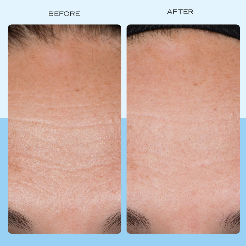 Dispense shot of First Aid Beauty Firming Cream for easy application