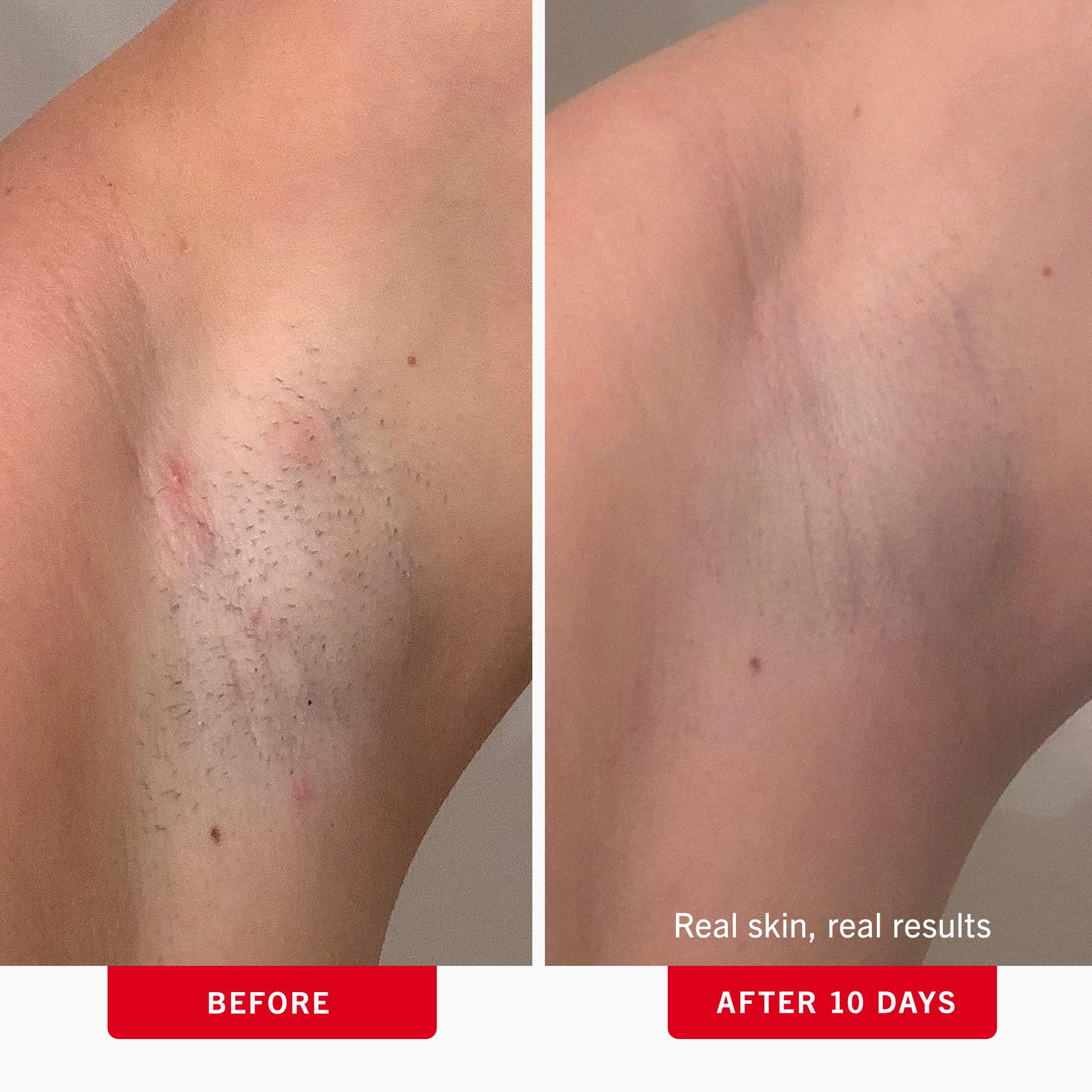 First Aid Beauty pads single wipe illustrates convenient one-time exfoliation