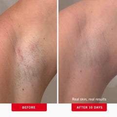 First Aid Beauty pads single wipe illustrates convenient one-time exfoliation