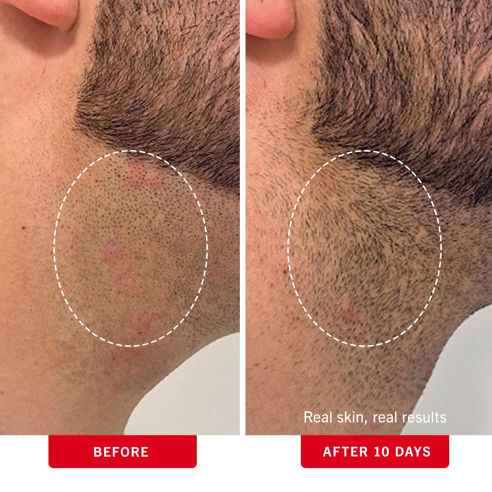 First Aid Beauty pads application on underarm shows quick refresh