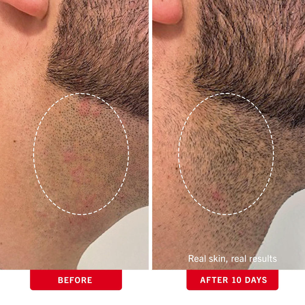 First Aid Beauty pads application on underarm shows quick refresh