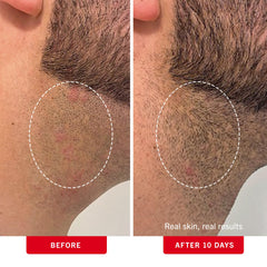 First Aid Beauty pads application on underarm shows quick refresh
