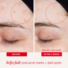 First Aid Beauty lactic acid lotion cream texture close-up.