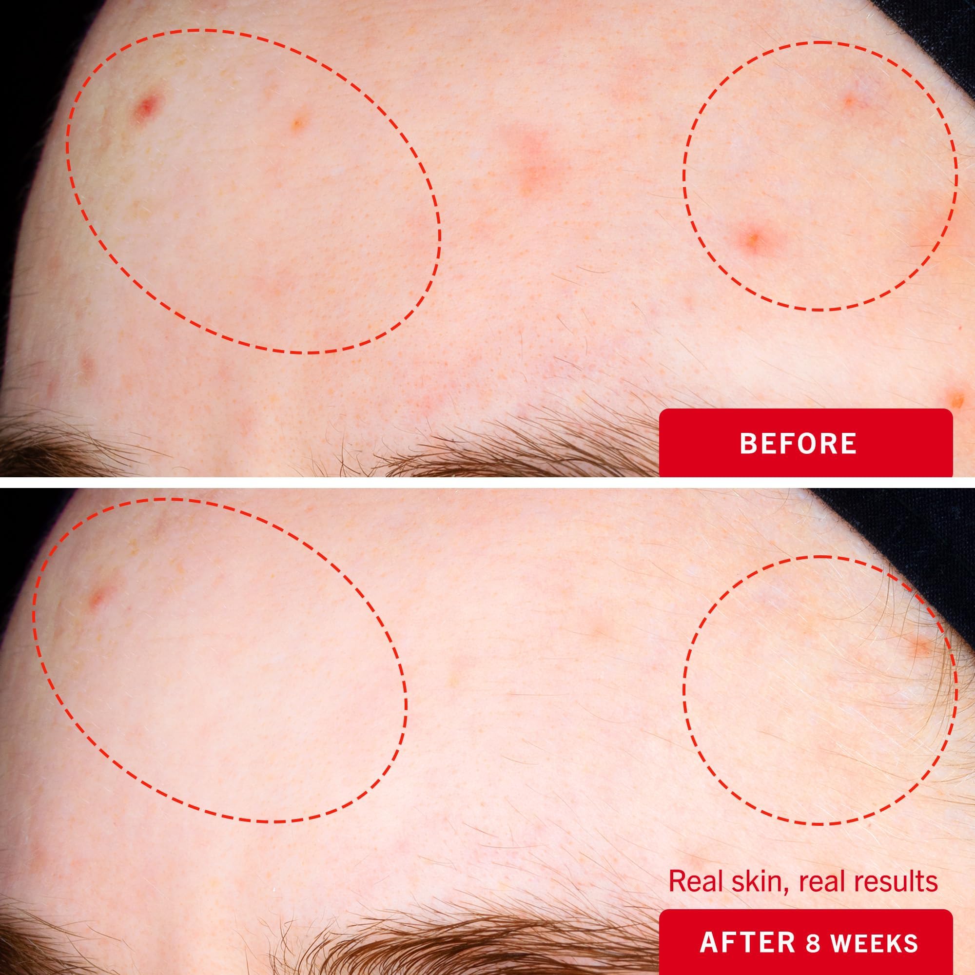First Aid Beauty swatch on skin showing even tone.