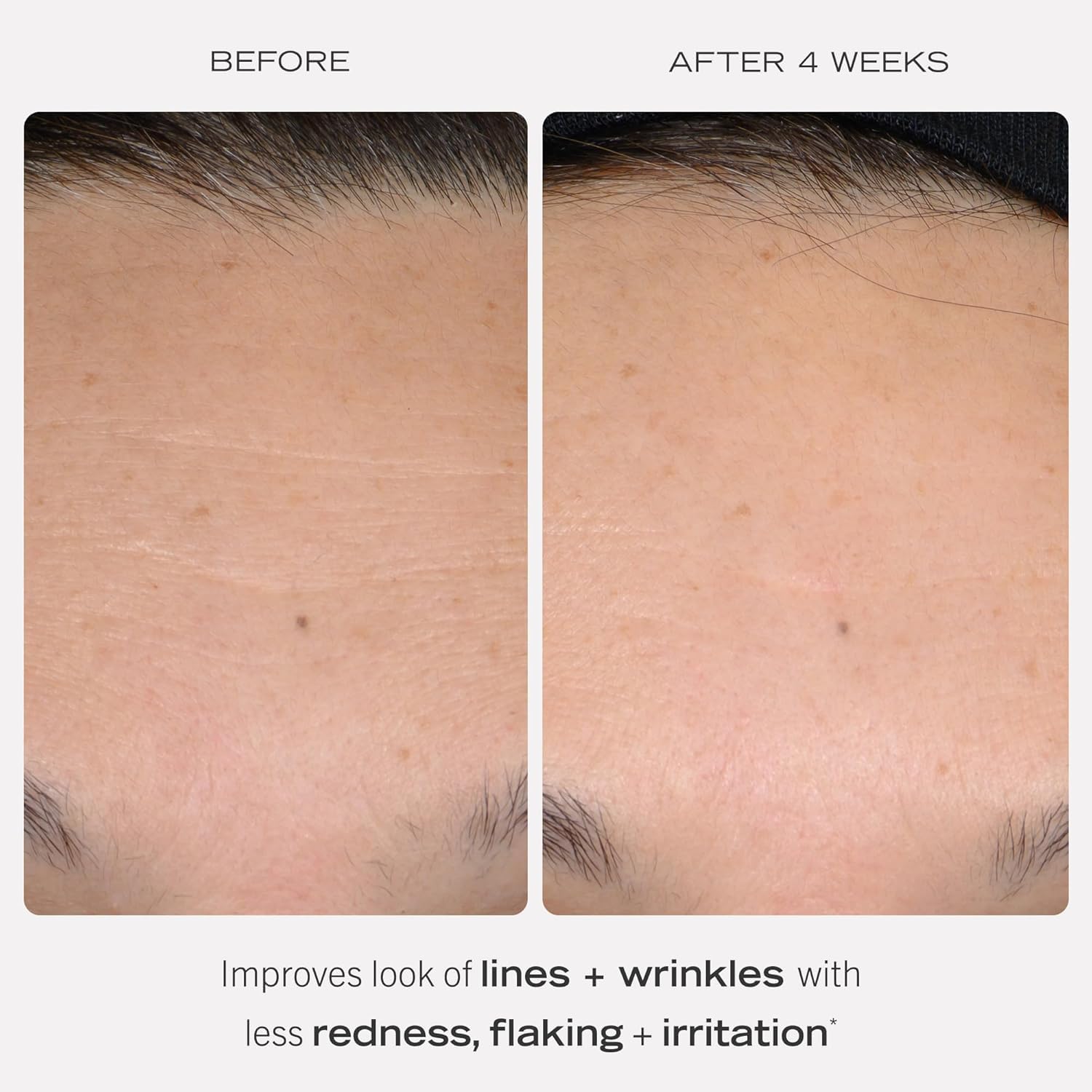 First Aid Beauty Retinol Complex Serum label close-up, highlighting 0.3% retinol and peptides.