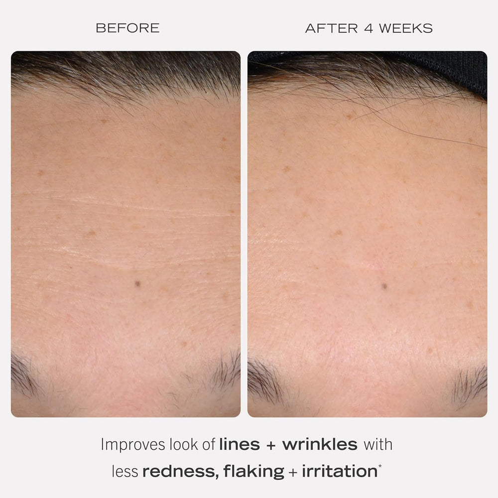 First Aid Beauty Retinol Complex Serum label close-up, highlighting 0.3% retinol and peptides.