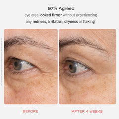 First Aid Beauty Retinol Eye Cream tube highlighting Squalane and Ceramides for hydration.