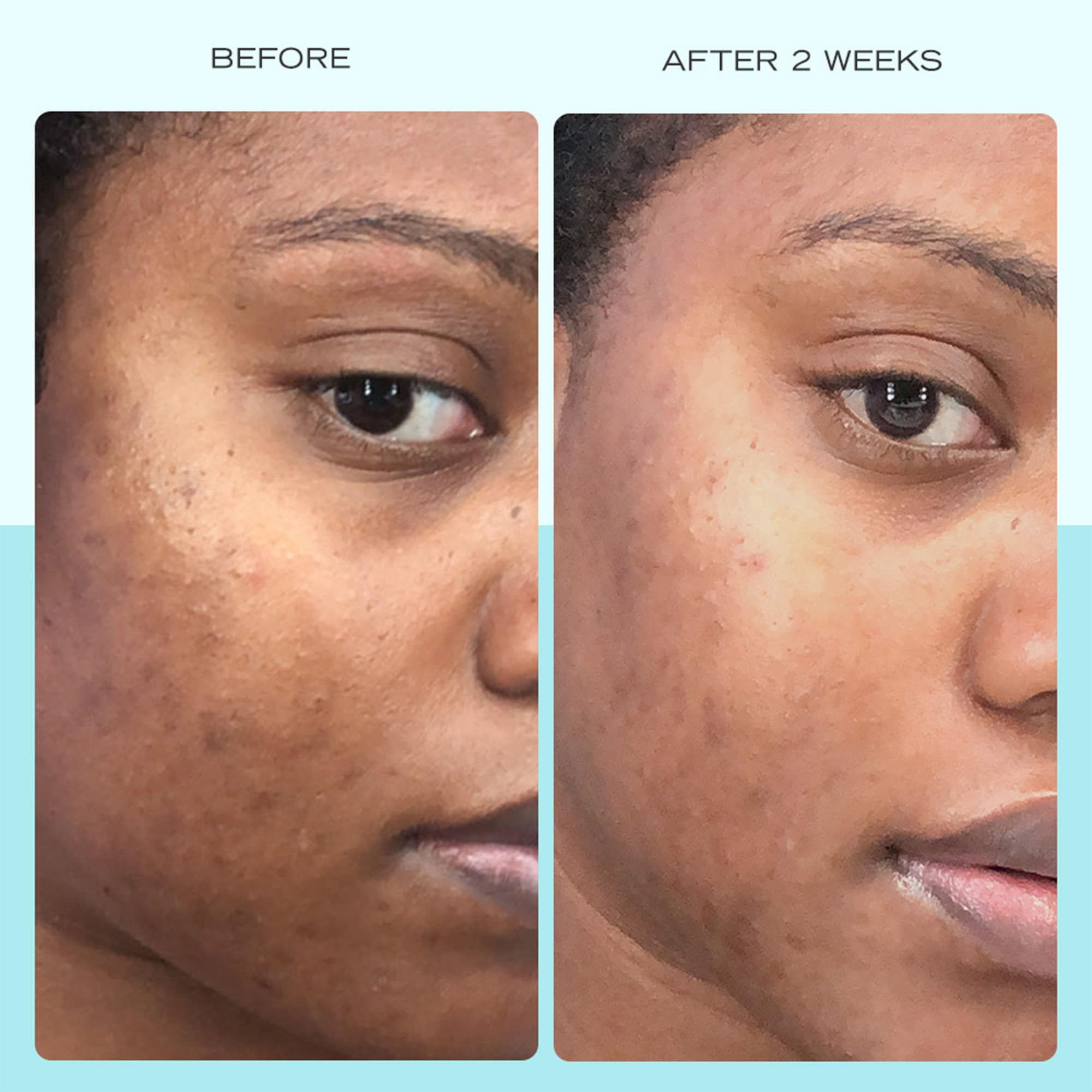 First Aid Beauty serum texture close-up showing a lightweight, soothing feel.