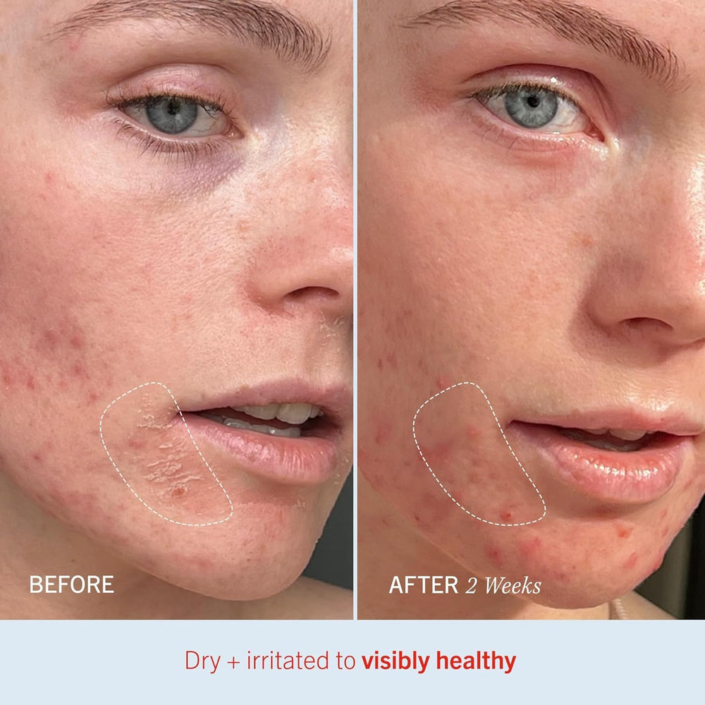 Thin layer applied on dry skin to illustrate daily hydration with Ultra Repair Cream
