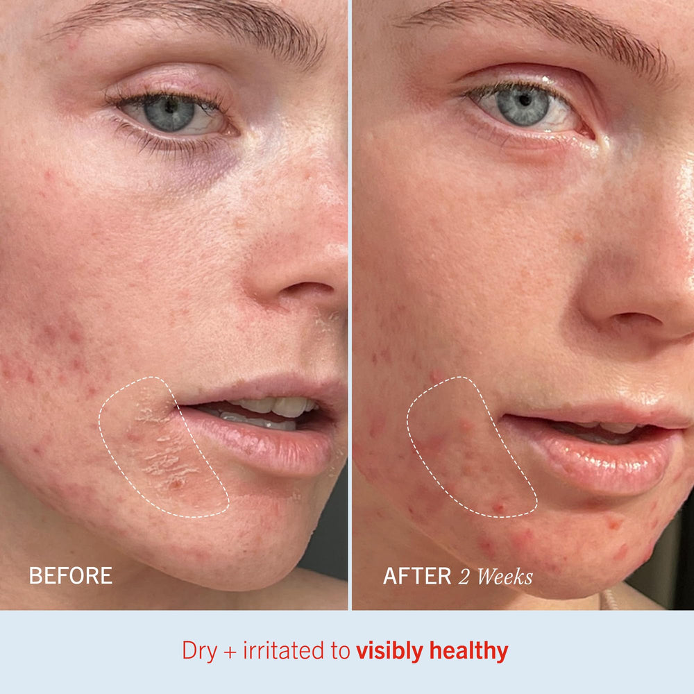 First Aid Beauty Ultra Repair Cream ingredient swirls illustrate emollient formula.