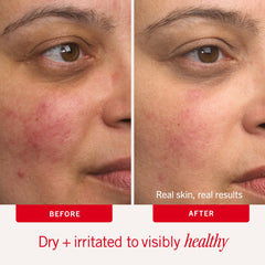 First Aid Beauty Ultra Repair Cream jar close-up highlights barrier-support ingredients.