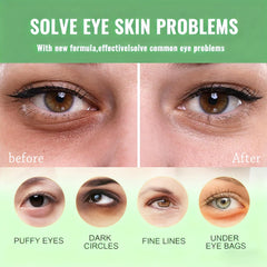 Firstfly hyaluronic acid and collagen eye patches for smoother eye area.