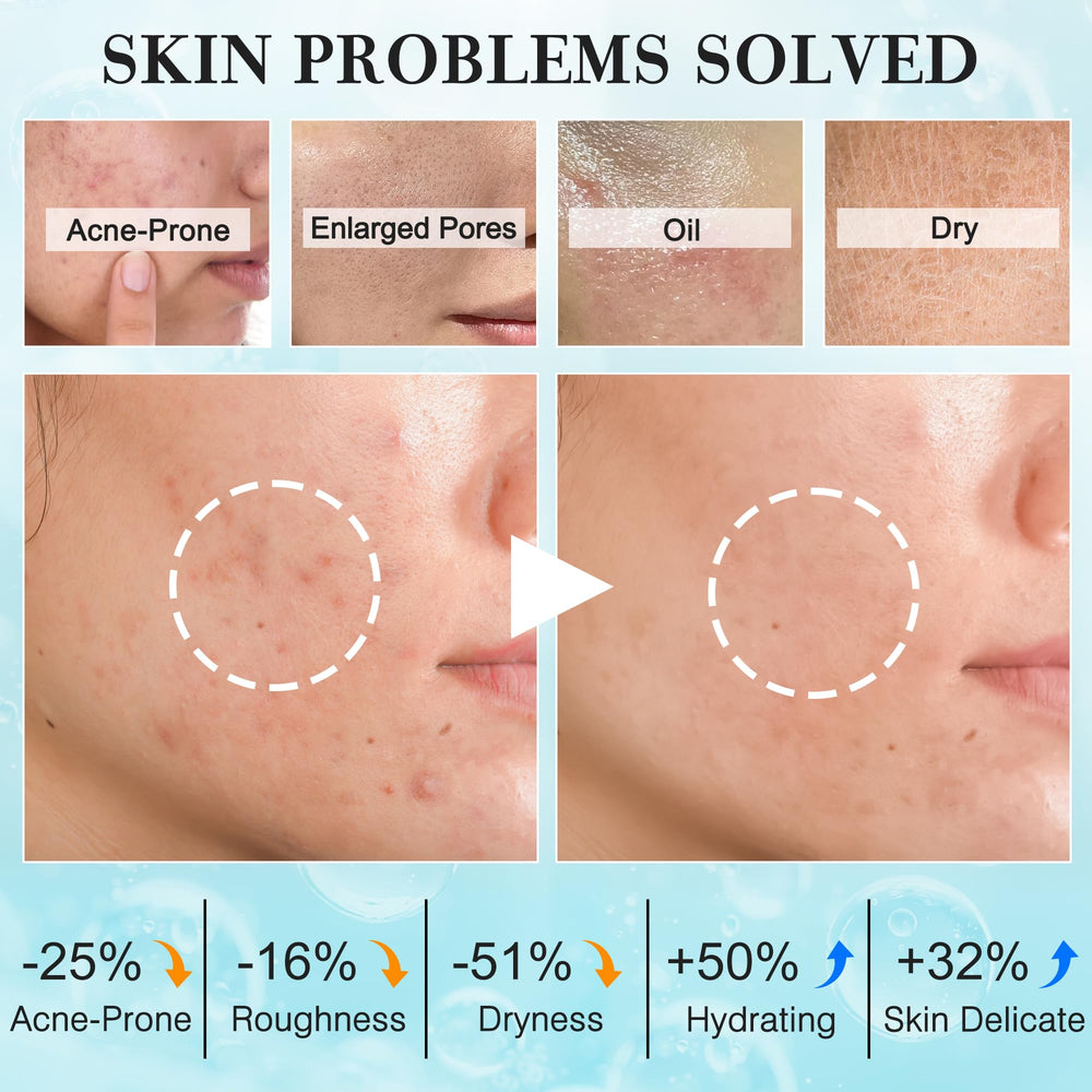 FITOEG Serum brightens the face and helps control shine for a balanced glow.