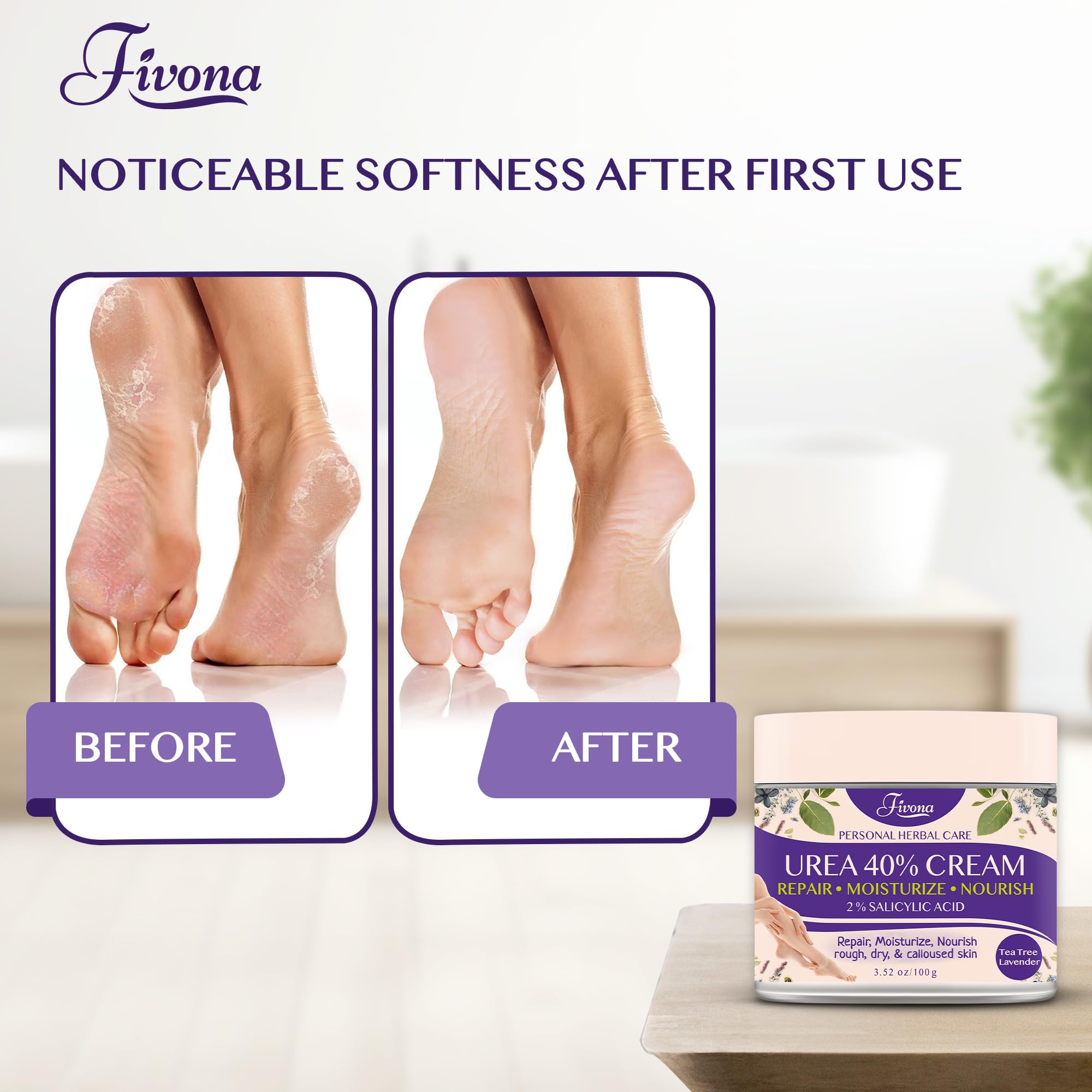 FIVONA nails and cuticles softened by the same formula.