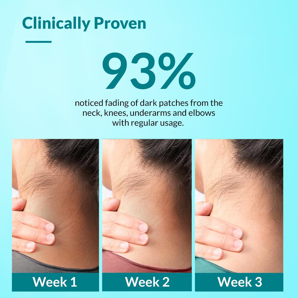 Urea in FIXDERMA Nigrifix cream supports hydration and barrier strength