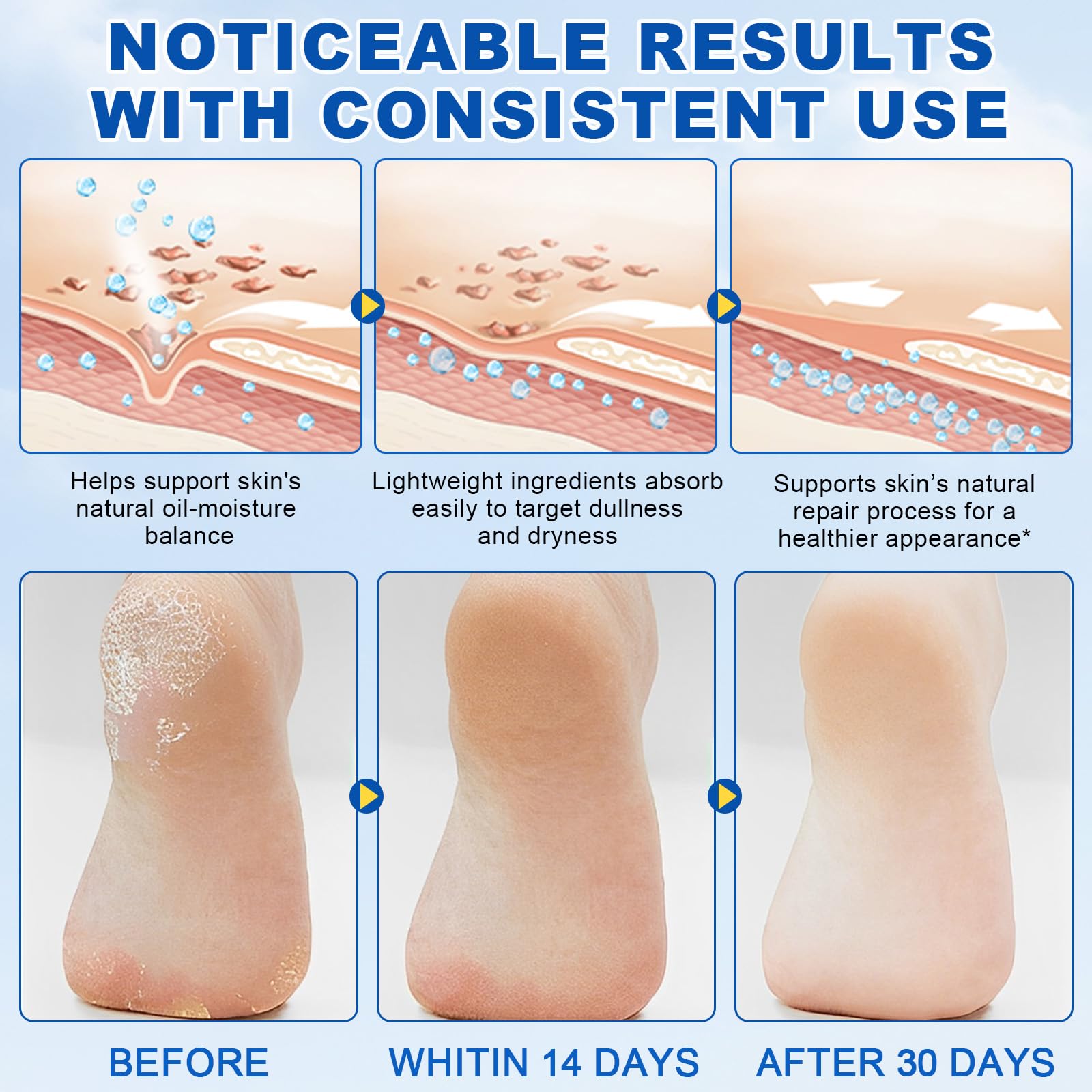 Applying Flasture stick to dry elbows and knees for exfoliation.