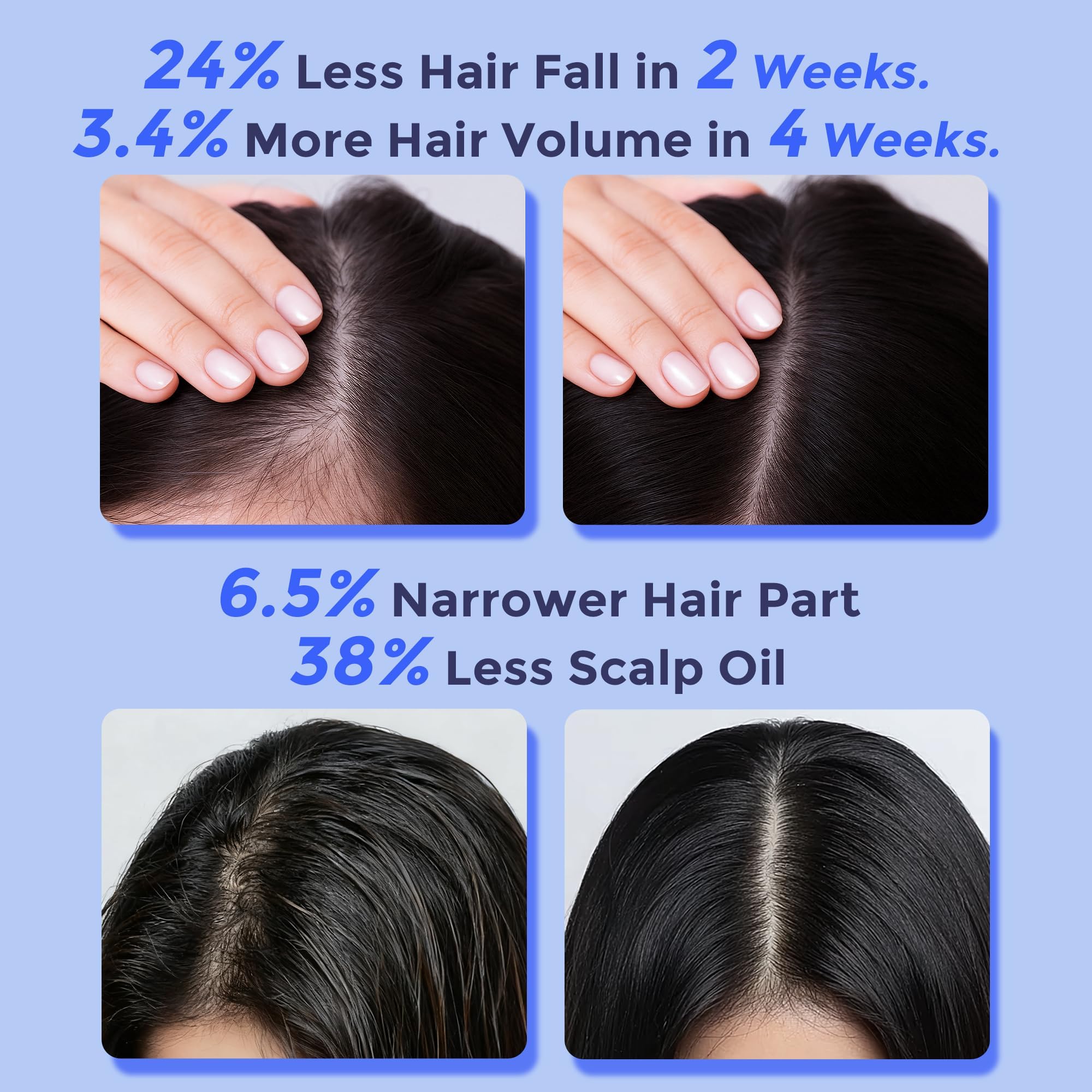 Fleur Luxxe Rosemary Serum Roll-On on scalp demonstrates precision roll-on delivery