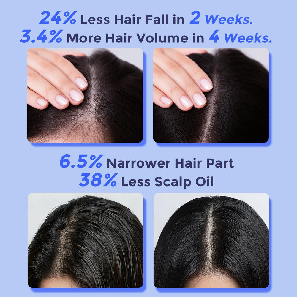 Fleur Luxxe Rosemary Serum Roll-On on scalp demonstrates precision roll-on delivery