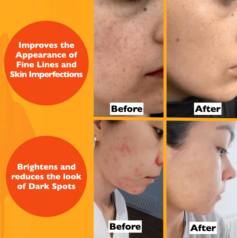 Hands applying Florence serum to the cheek for a refreshed glow