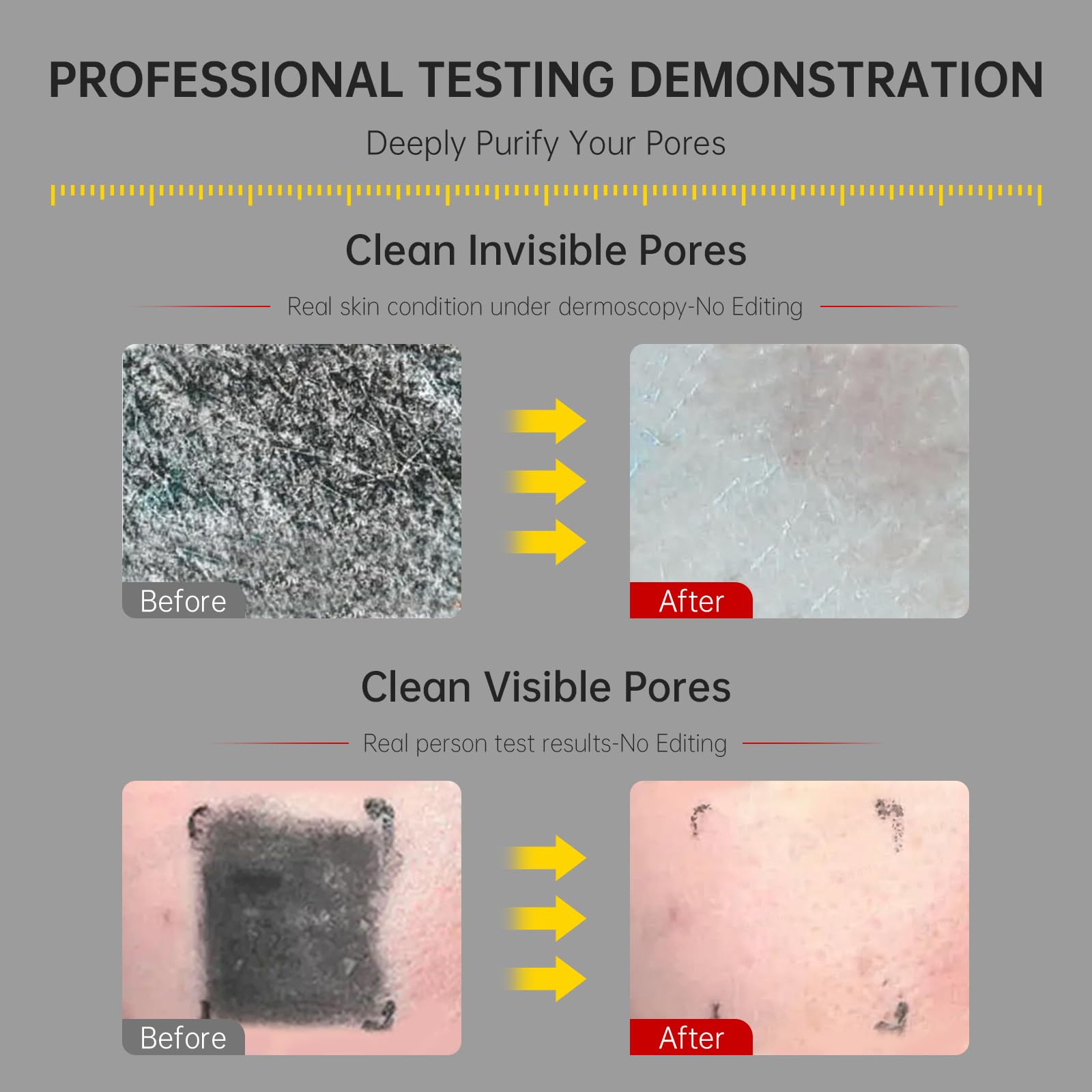 Flyleaf gray mud film deep cleans pores without overdrying.